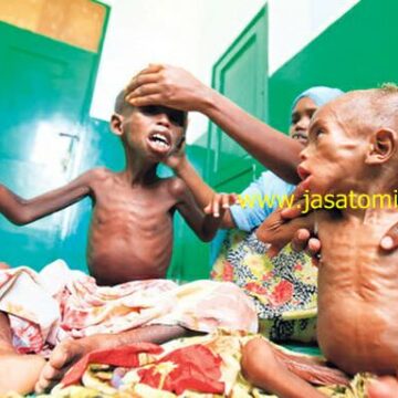 Deca umiru od gladi na rogu Afike